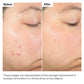 Salicylic Acid 2% Exfoliating Blemish Solution